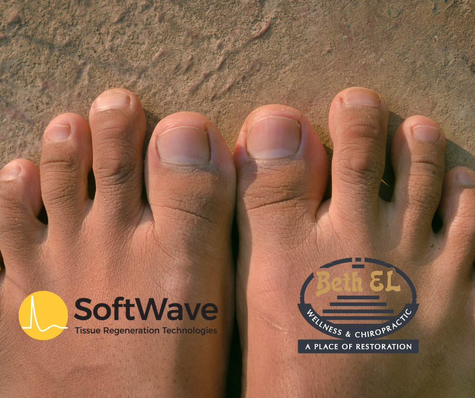 A Breakthrough for Morton's Neuroma at Beth EL Wellness & Chiropractic with SoftWave Tissue Regeneration Technology (TRT)